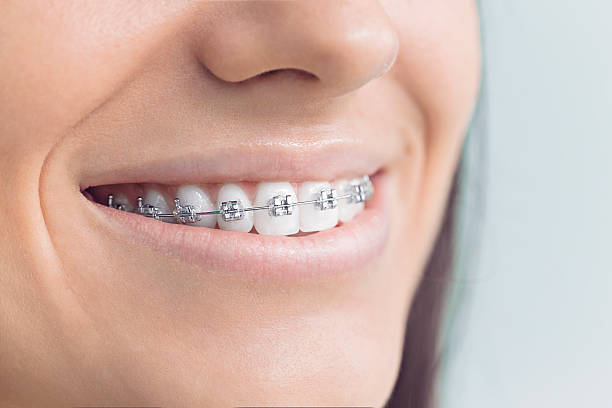 Trusted Arlington, NY  Holistic Dental Services Experts